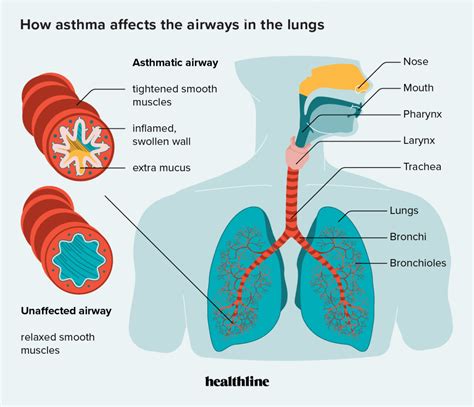 How The Flu Can Affect Your Lungs According To A Respiratory Therapist